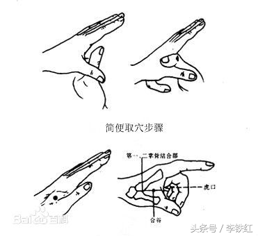 李铁红院长：清热止痛-合谷穴