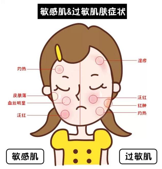 敏感肌一到换季就脸红过敏,脸红一定是敏感肌吗