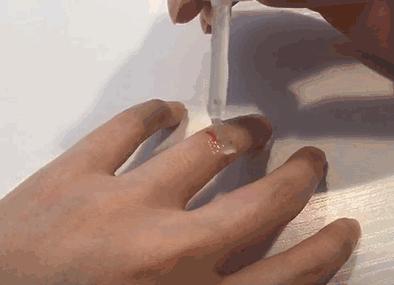 创可贴贴住的伤口更难愈合,晚上睡觉伤口贴创可贴好还是不贴