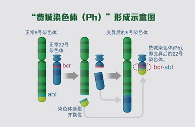 白血病神药格列卫多少钱一瓶,白血病神药格列卫