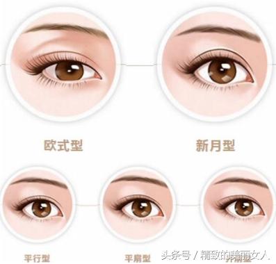 结合红楼梦中的美人，看看你适合哪种双眼皮