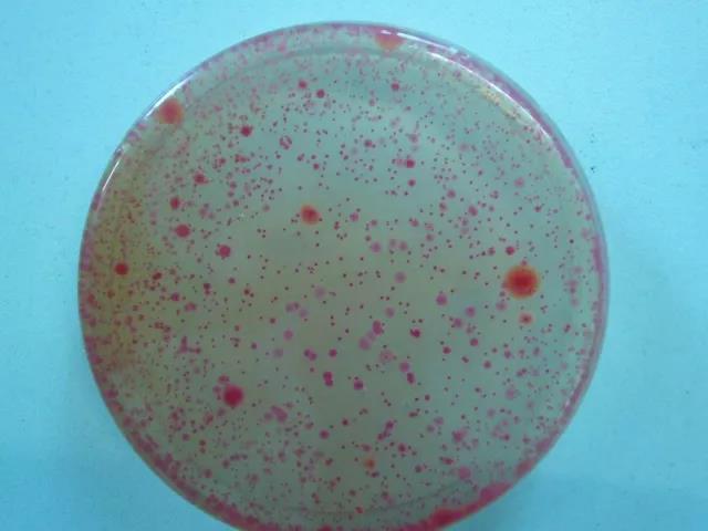 森田治疗最新消息,森田面膜出问题的是哪个