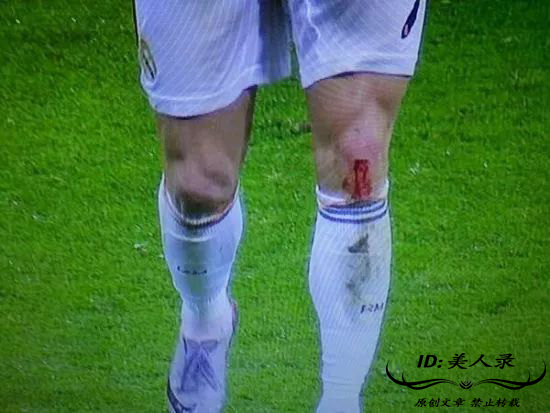 c罗受过最重的伤视频,c罗那些年欧冠