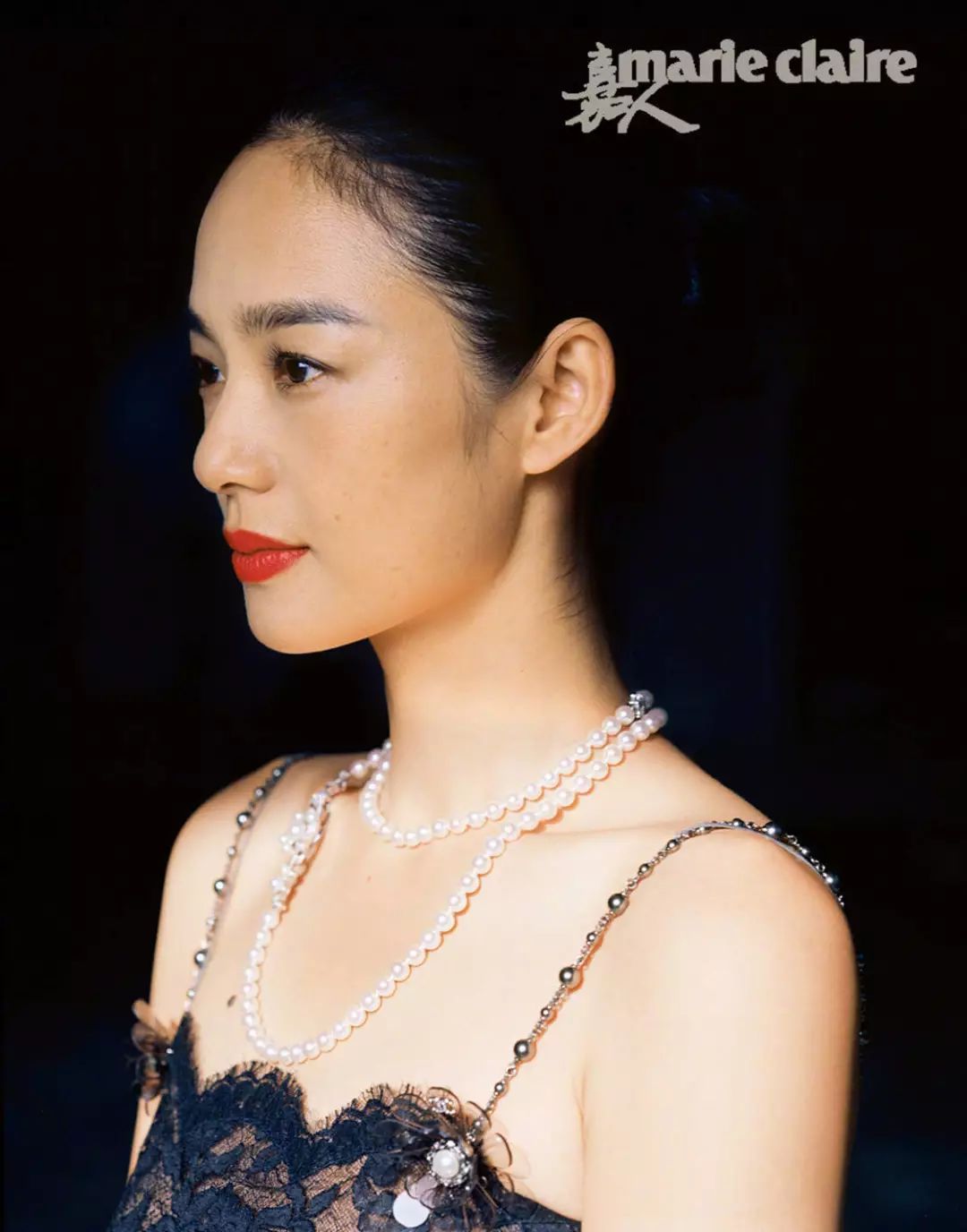 揭秘种植发际线,发际线种植真实体验