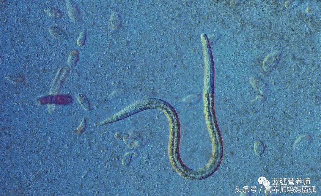 怎么判断孩子斑点是不是白癜风,宝宝身上长白斑是缺什么