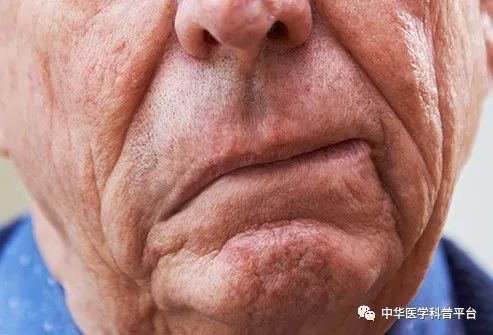 高血压停药的危害,高血压的危害视频