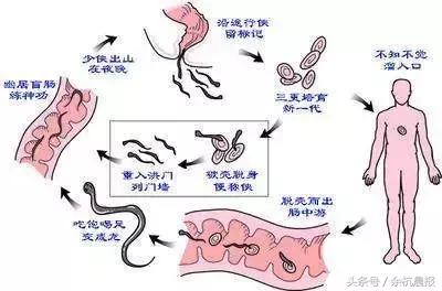 小孩有白色小虫,小孩有白色小虫子