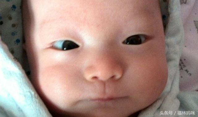 小时候宝宝斗鸡眼注意事项,怎样判断宝宝眼睛是不是斗鸡眼