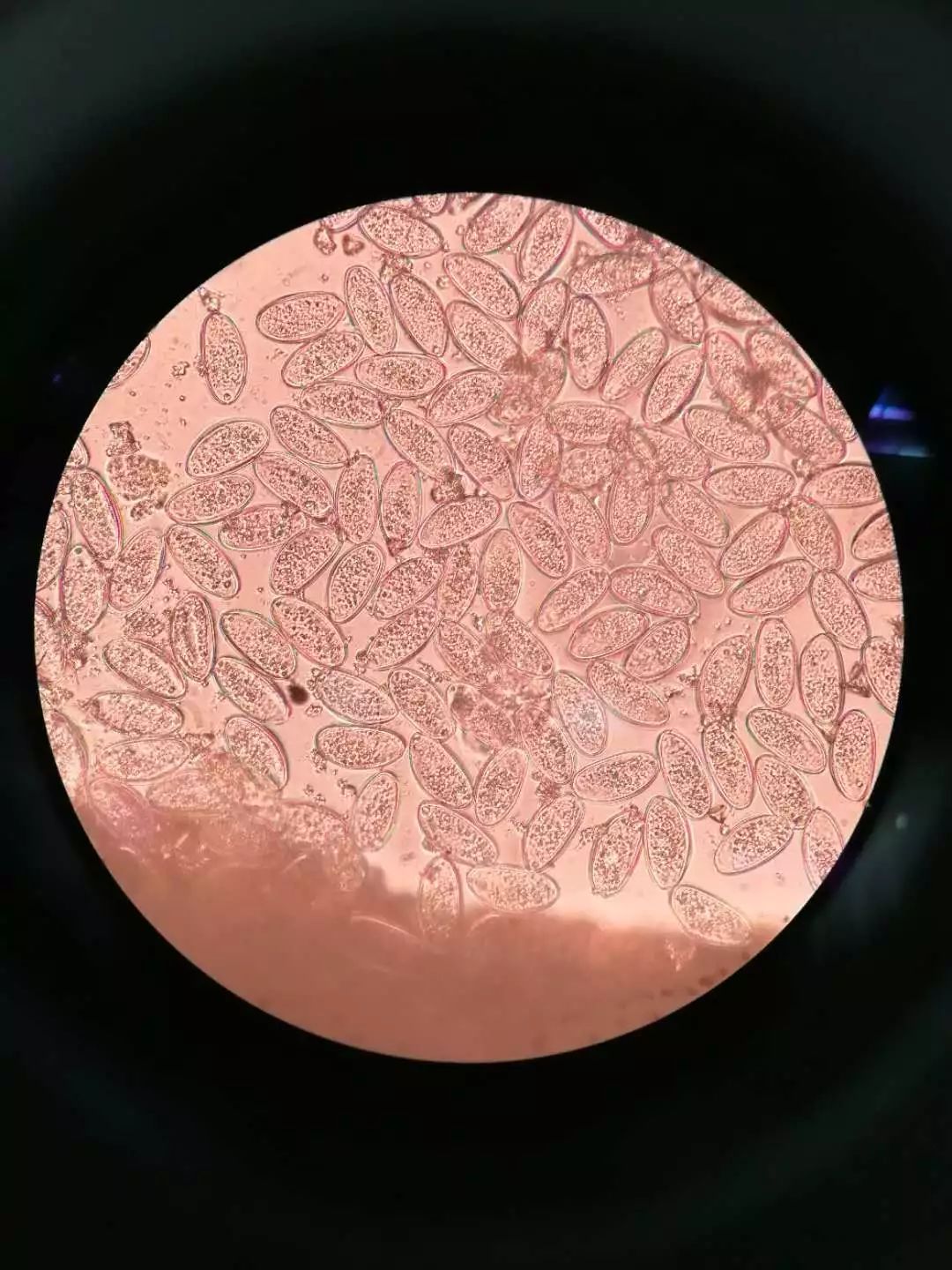 孩子屁股疼去医院了,小孩屁股疼还带血