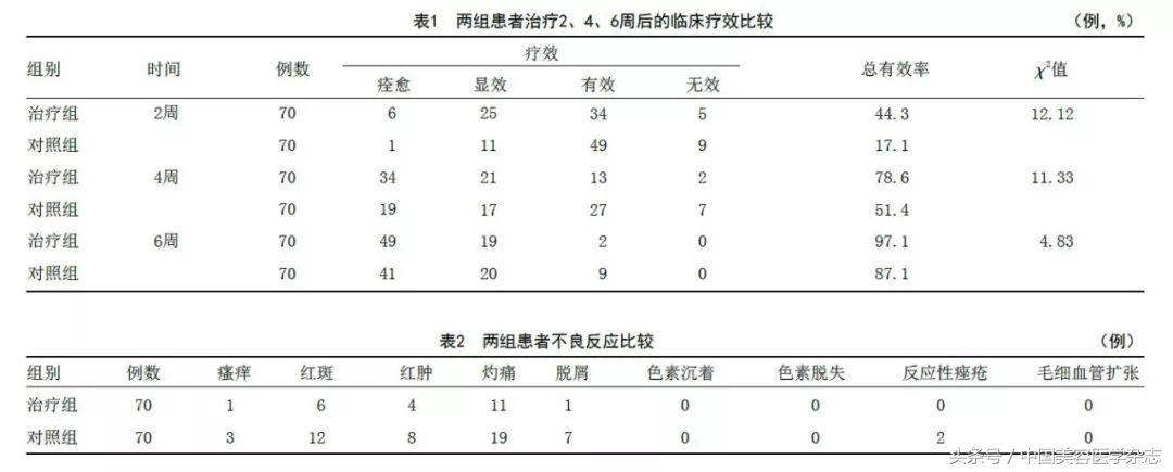 面部痤疮有什么危害,严重性痤疮要注意什么