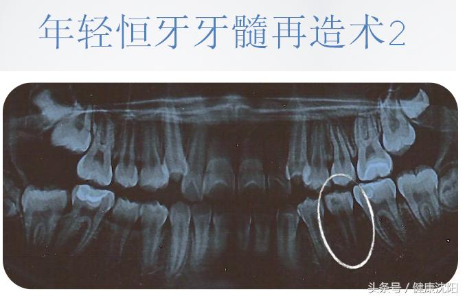 健康科普牙科,健康科普口腔科普