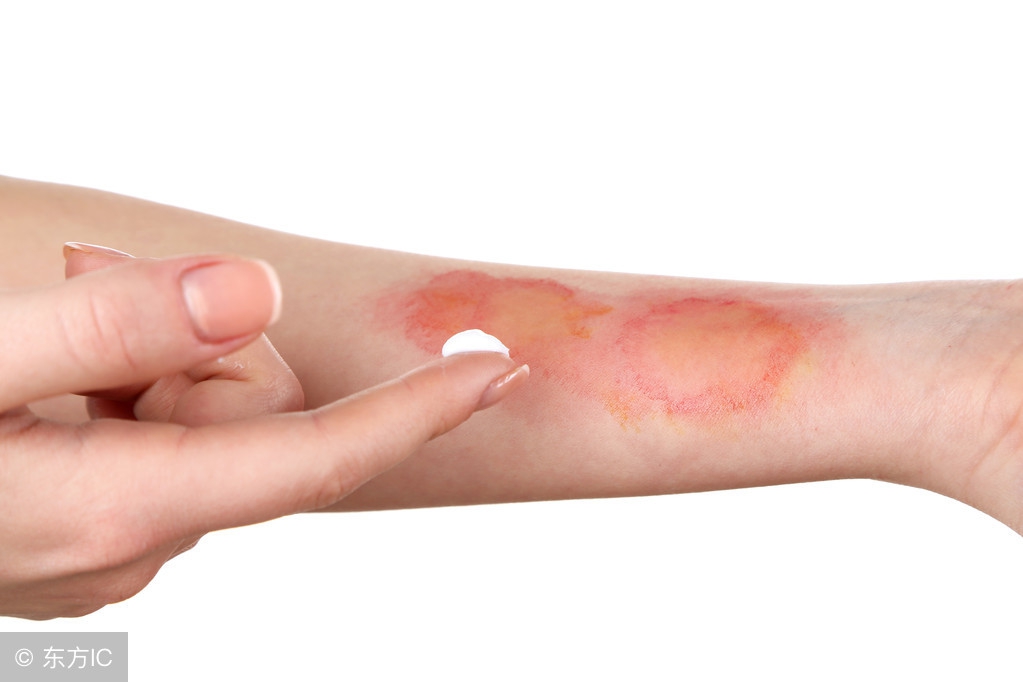 风油精孕妇可以用吗？它还有哪些不为人知的用途？