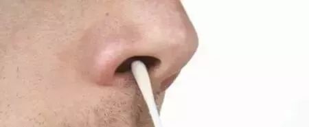 隆鼻手术后会不会一碰就变形,隆鼻术后假体移位怎么办