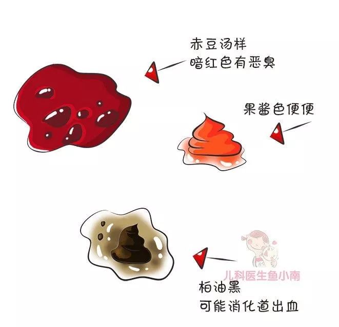 如何辨别婴儿大便性状,宝宝大便性状有哪些