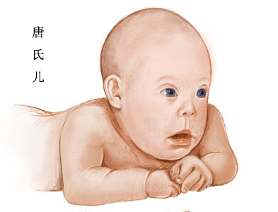 唐氏儿童长大后没有生育能力吗,唐氏综合征的孩子有生育能力吗