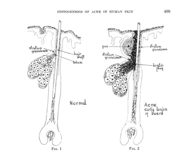 为什么别人的青春期没有痘痘？本期文章不藏私战痘好物起底