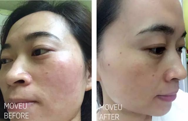 “万用”紫草膏，解决了你多少皮肤烦恼？