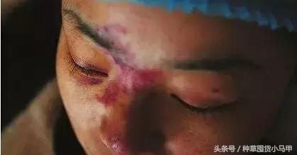 整形医生黑幕完整版,整形黑幕