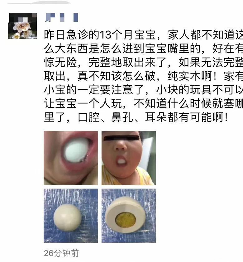 仔细检查你家孩子这个部位，你永远想不到孩子会把异物塞进这里！