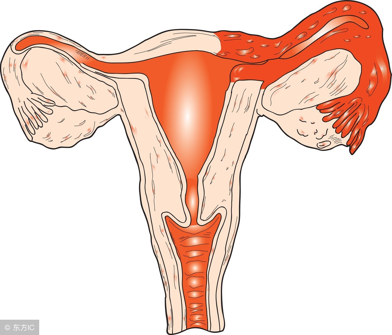 上厕所频繁有什么妇科病,上厕所多是妇科病吗