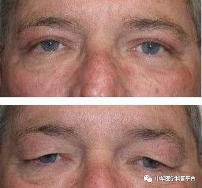 整形课,整形为什么越来越难看