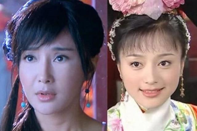 秦岚霸气回应打瘦脸针是为了上镜,秦岚谈瘦脸针