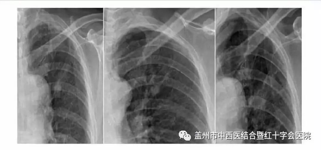 盖州人切记！对于疾病早发现、早治疗是成功治疗的关键！