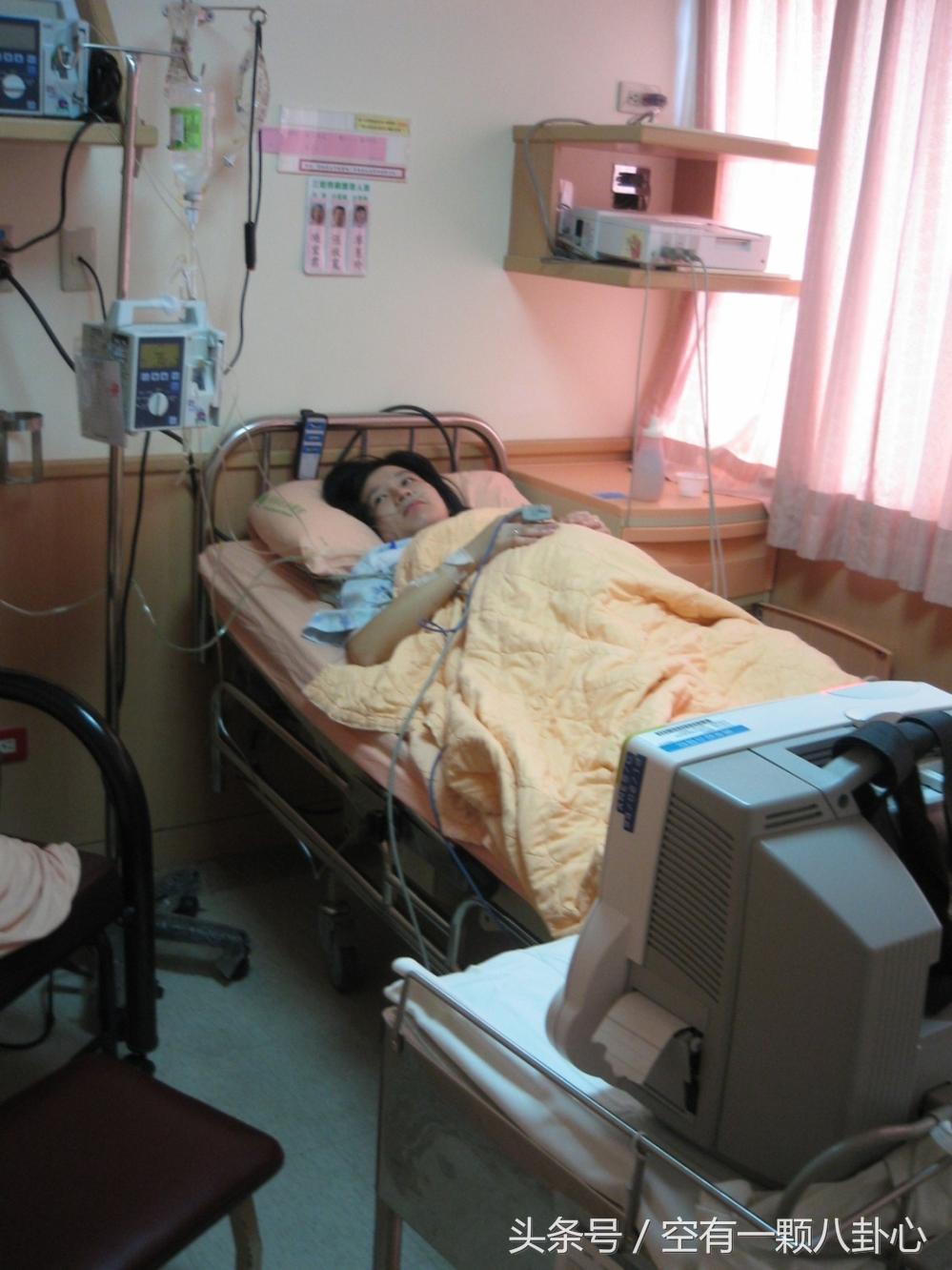 产前选项有什么重要性,产前好还是产后好