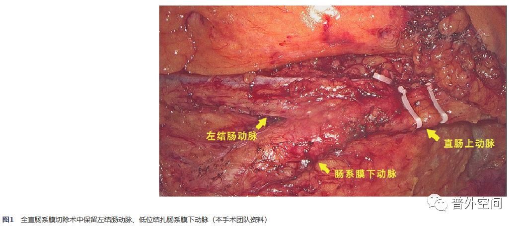 直肠癌吻合口瘘引流管,直肠癌术后吻合口瘘的护理