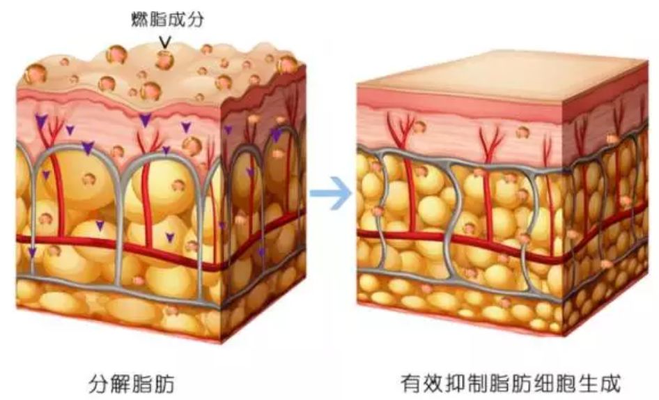 穿着就能瘦腿的裤子真的有用吗,穿瘦腿裤睡觉可以瘦腿吗