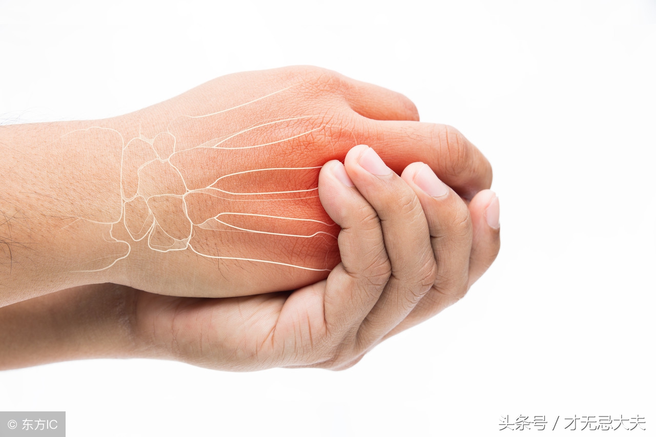 类风湿性关节炎的预防和治疗方法,类风湿性关节炎怎么治疗好得快