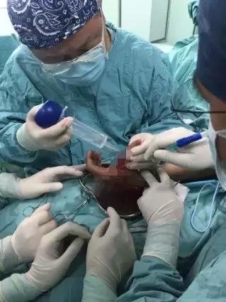 可乐打开方法,可乐为什么禁止零度以下冷冻