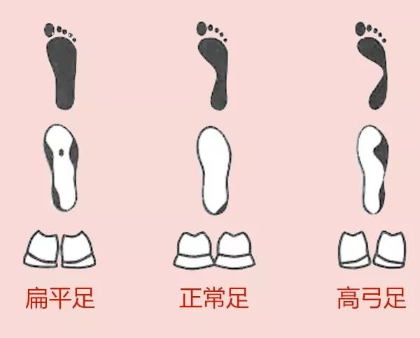 抬脚看鞋底的不同姿势,鞋底偏了哪里有问题
