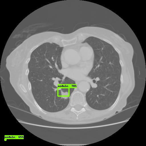 ibm沃森人工智能医疗最新状况,ibm沃森最新视频