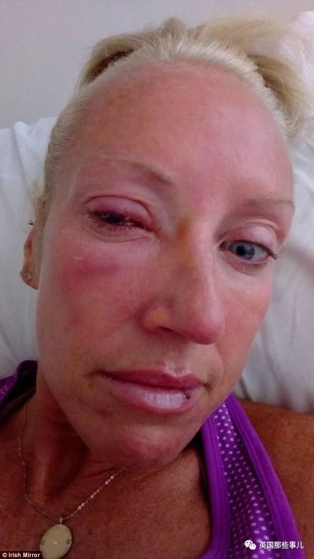 戴着隐形眼镜洗了一次澡,戴了隐形眼镜晚上还是看不清楚