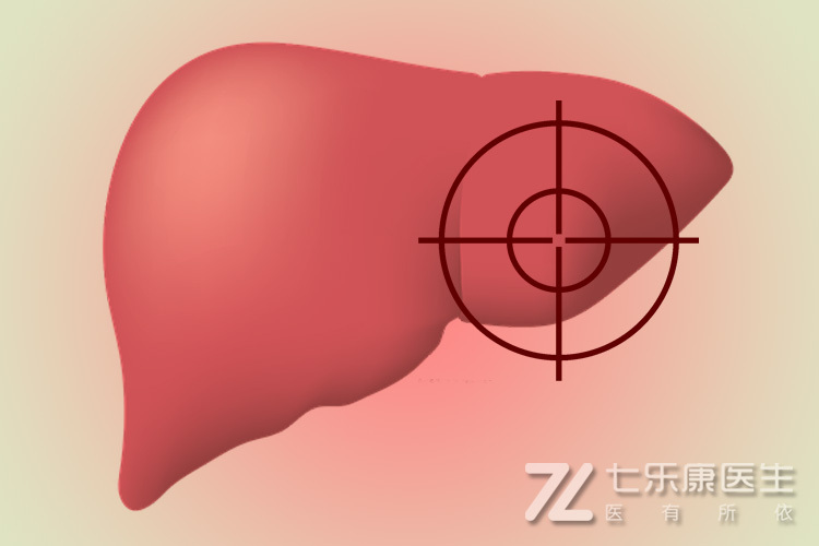 肝病专家能治好肝硬化吗,肝硬化是肝癌吗可以治愈吗