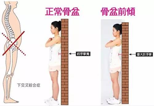 10分钟治腰背痛,一条毛巾治好腰背疼