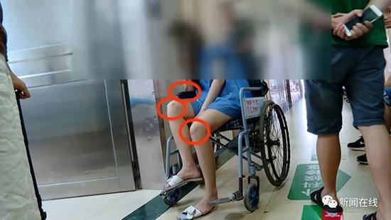 女子醉酒失忆被殴打,女子醉卧在路边