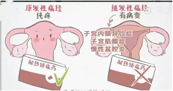 月经痛可以吃止痛药吗,大姨妈痛用什么止痛药