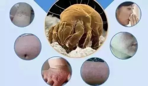 「科普生活」睡衣、床单多久洗一次？超过这个时间，百万螨虫细菌陪你睡