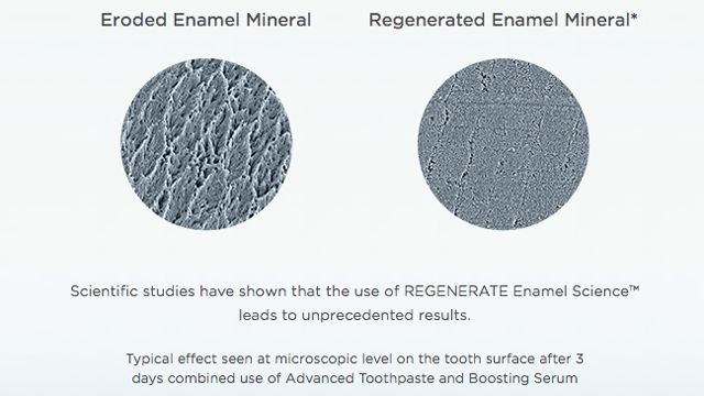 全球唯一一款修复牙釉质牙膏,修复牙釉质牙膏推荐