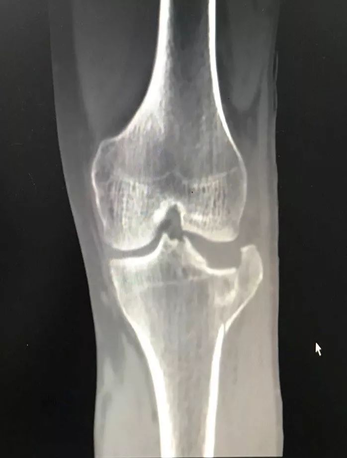 天玑加强版,新一代天玑