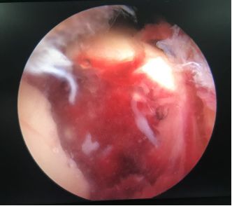 天玑加强版,新一代天玑