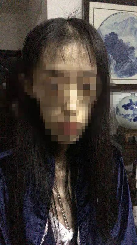 1米67才50斤！21岁女孩“自杀式减肥”，照片不忍直视……