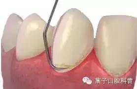 月子期间刷牙对牙齿有影响吗,月子怎么刷牙不伤害牙齿