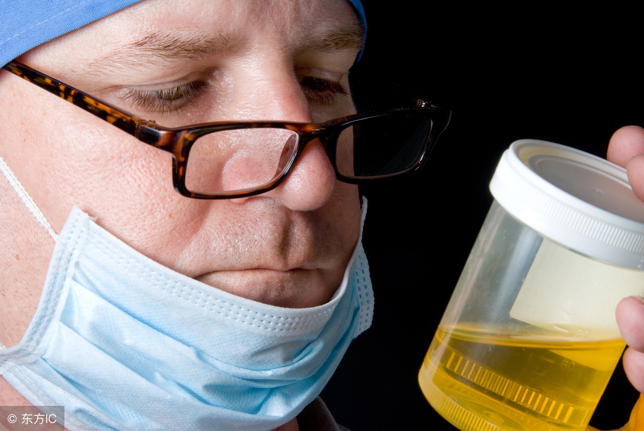 小便过后有种灼热感怎么回事,小便完后有灼热感是什么原因