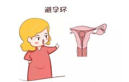 取环后多久怀孕是最佳时期,取环多久可以怀孕生小孩