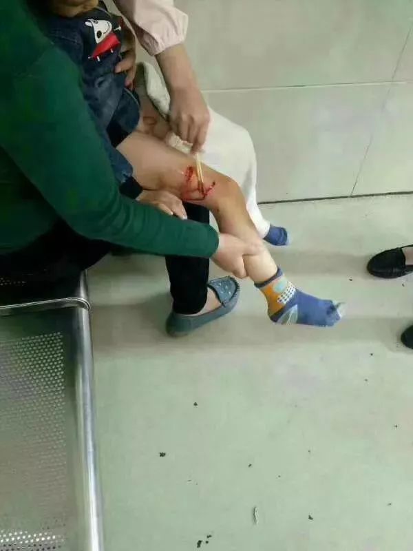 被狗咬住不放怎么办,被狗咬着不松口怎么快速脱离