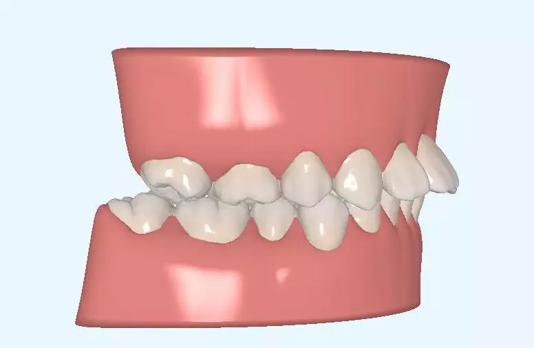 超实用的拔牙小技巧有哪些,拔牙知识图片