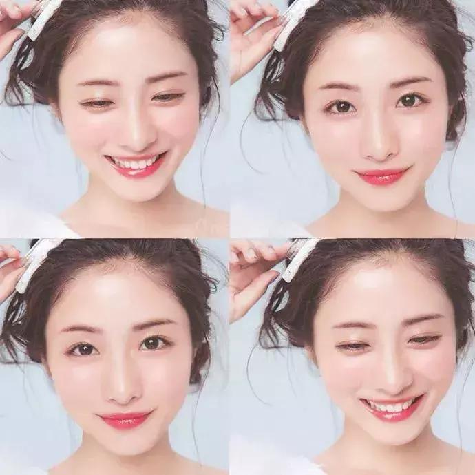 整容不可怕了可怕的是整容失败,整容有风险